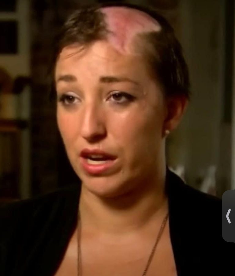 Mom Of 4 Scalped Seconds After Making Simple Mistake, Sends Warning To All Other Women