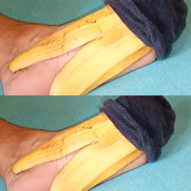 Think Twice Before Tossing Banana Peels!