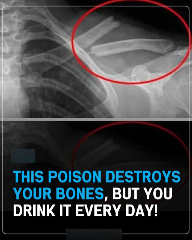 This drink will destroy your bones from the inside but millions of people consume it every day