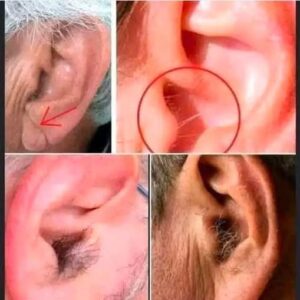 Did you know that if your ear hairs grow, it is because your body is