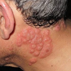 These are the consequences of sleeping with the…See more