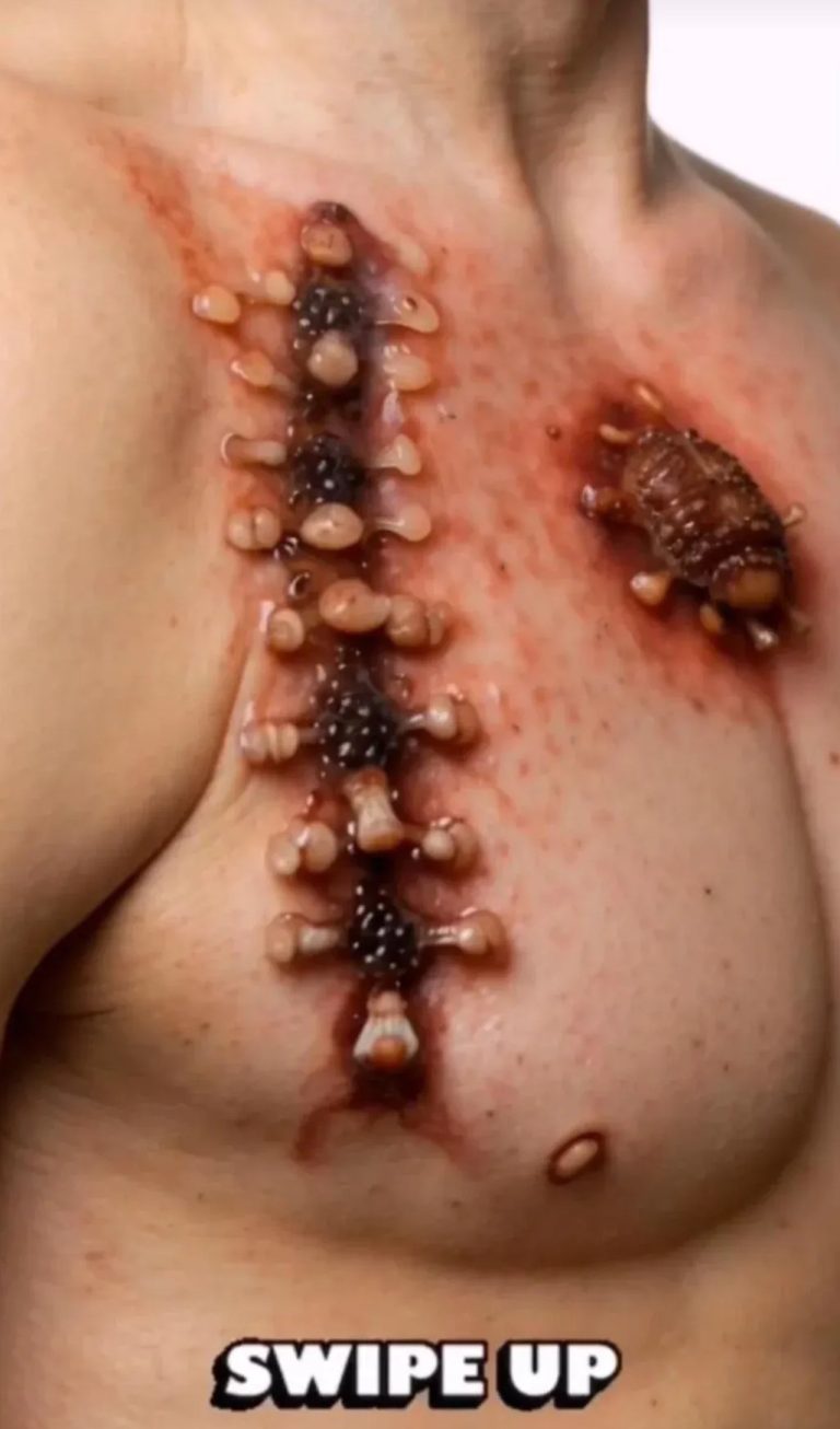 Skincare Tip for a Healthy Glow — What You Need to Know! ✨Say goodbye to common skin issues with this simple, effective approach!