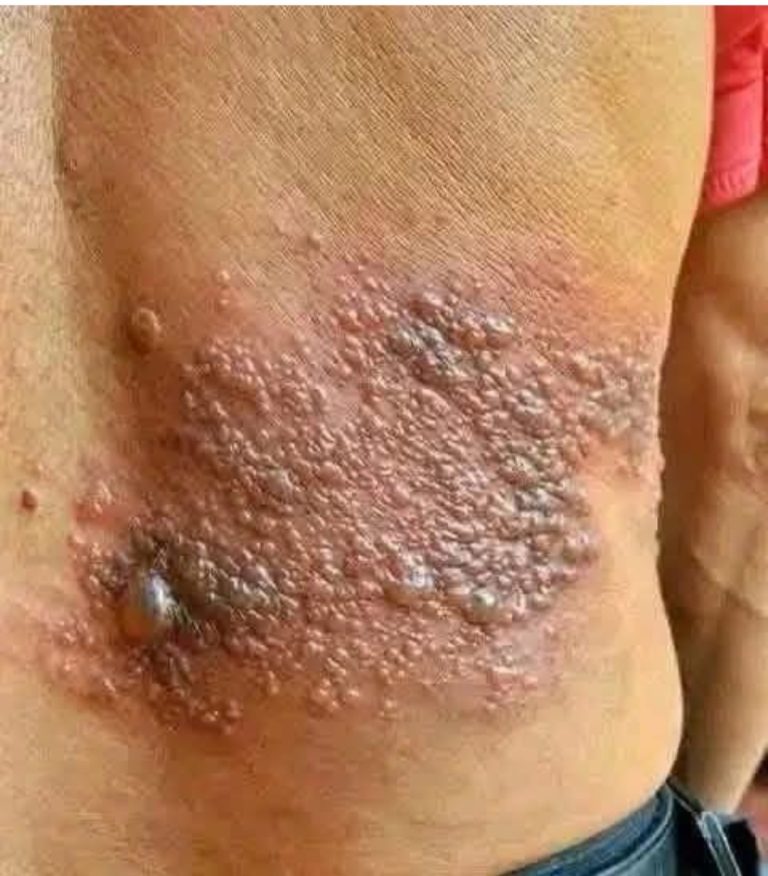 It was itching his body, he thought it was an allergy, but a tough diagnosis… See more