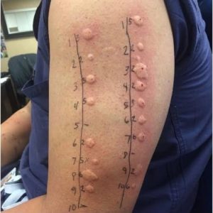 These are the consequences of sleeping with the… See more