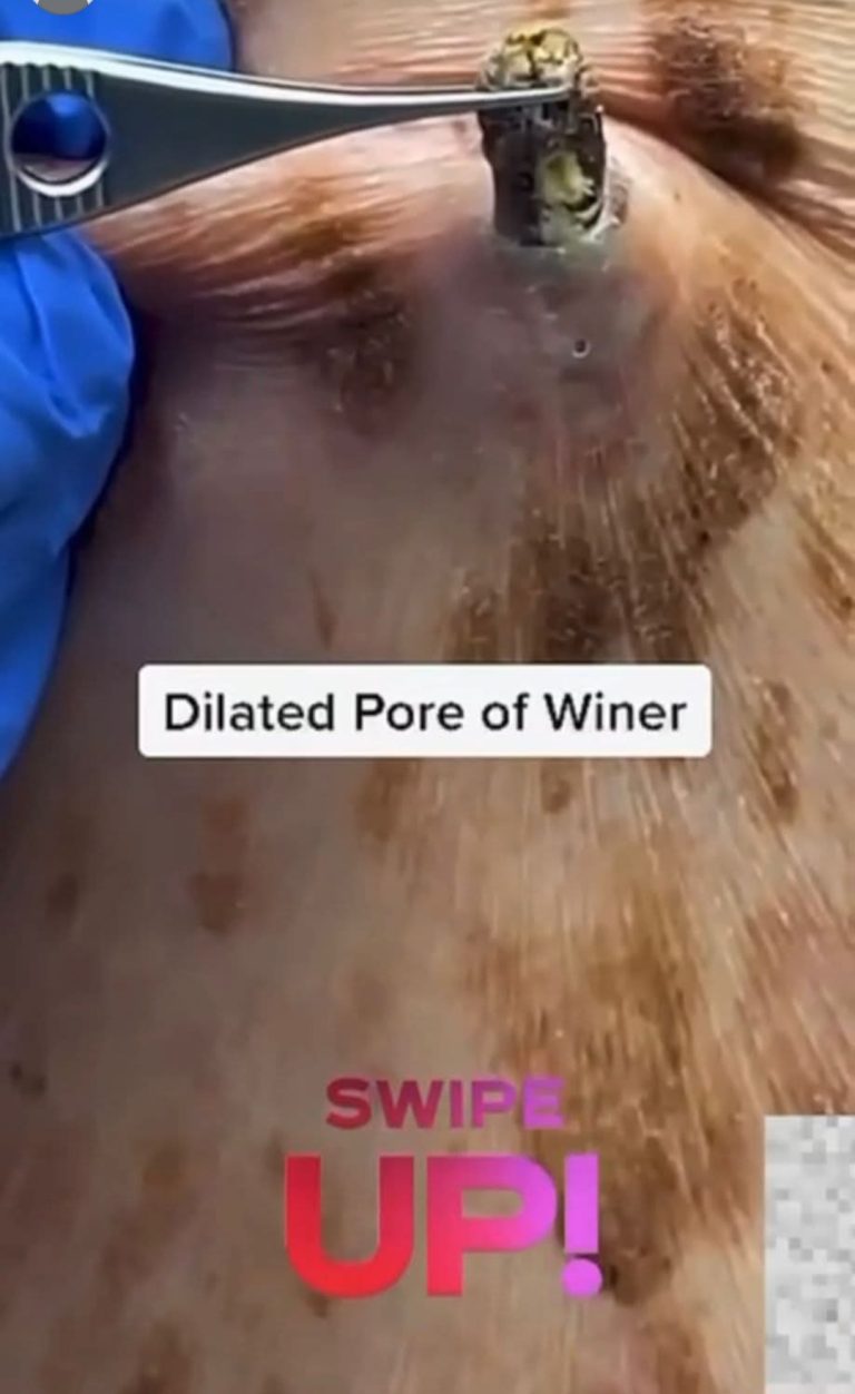 **🔍 “The Dark Spot That Isn’t Just a Spot…”