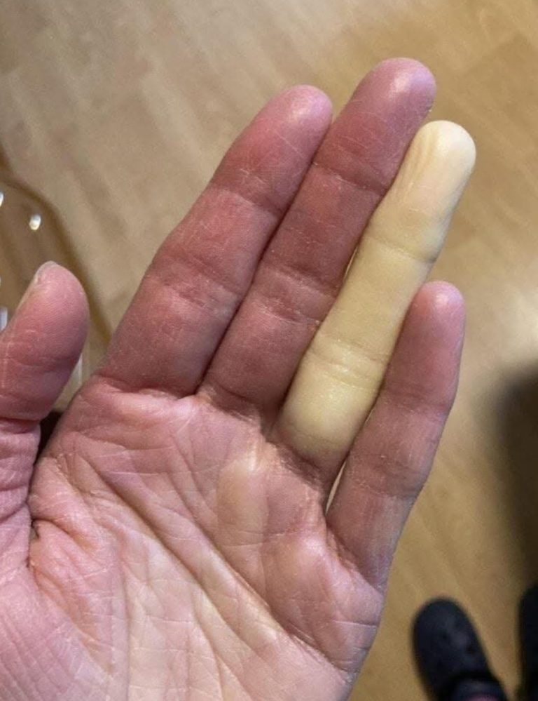 These are the consequences of sleeping with the… See more