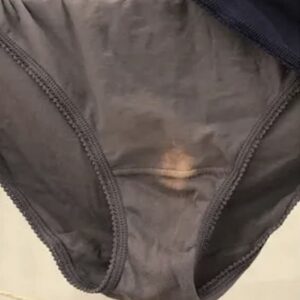 If You See A ‘Bleach’ Patch On Your Underwear, Here’s What It Means