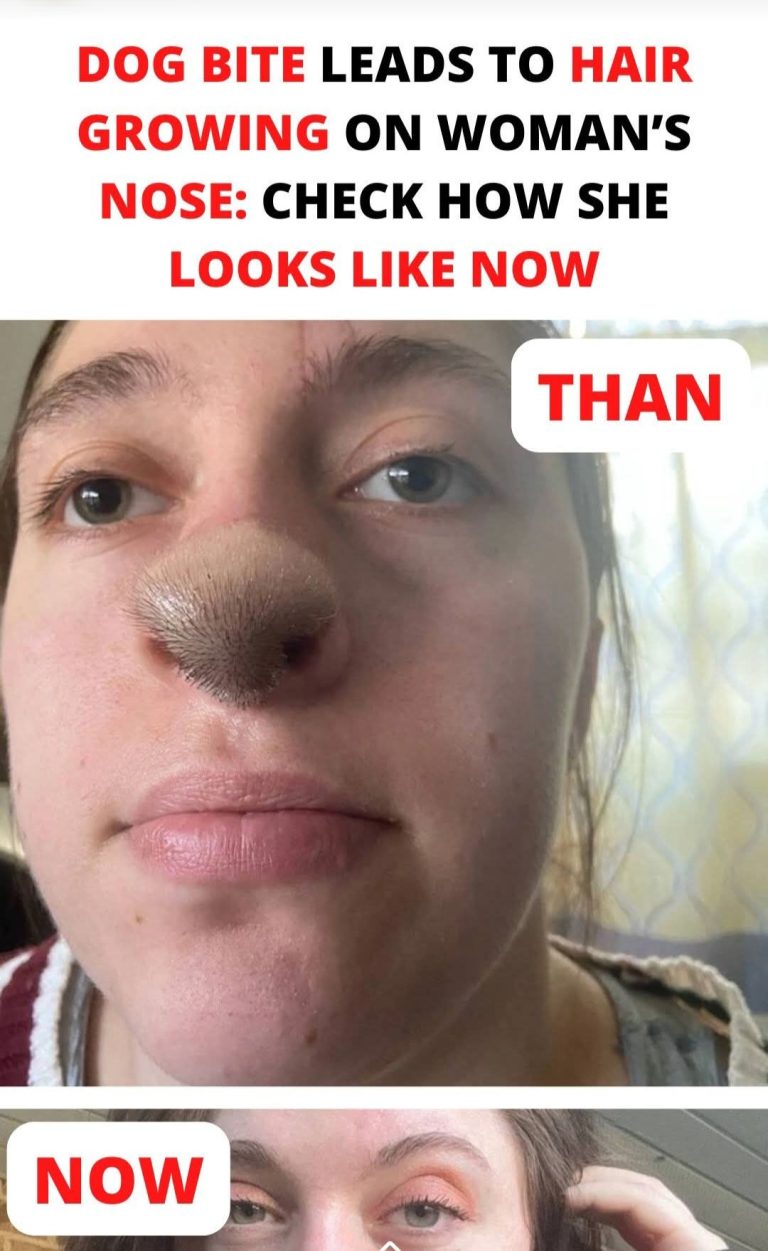 Attacked by a Family “Rescue” Dog, She Rebuilt Her Life — and Turned Her Recovery Into a Message of Strength