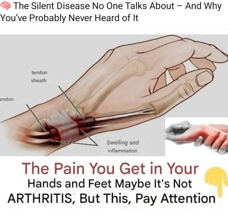 The Silent Disease No One Talks About – And Why You’ve Probably Never Heard of It