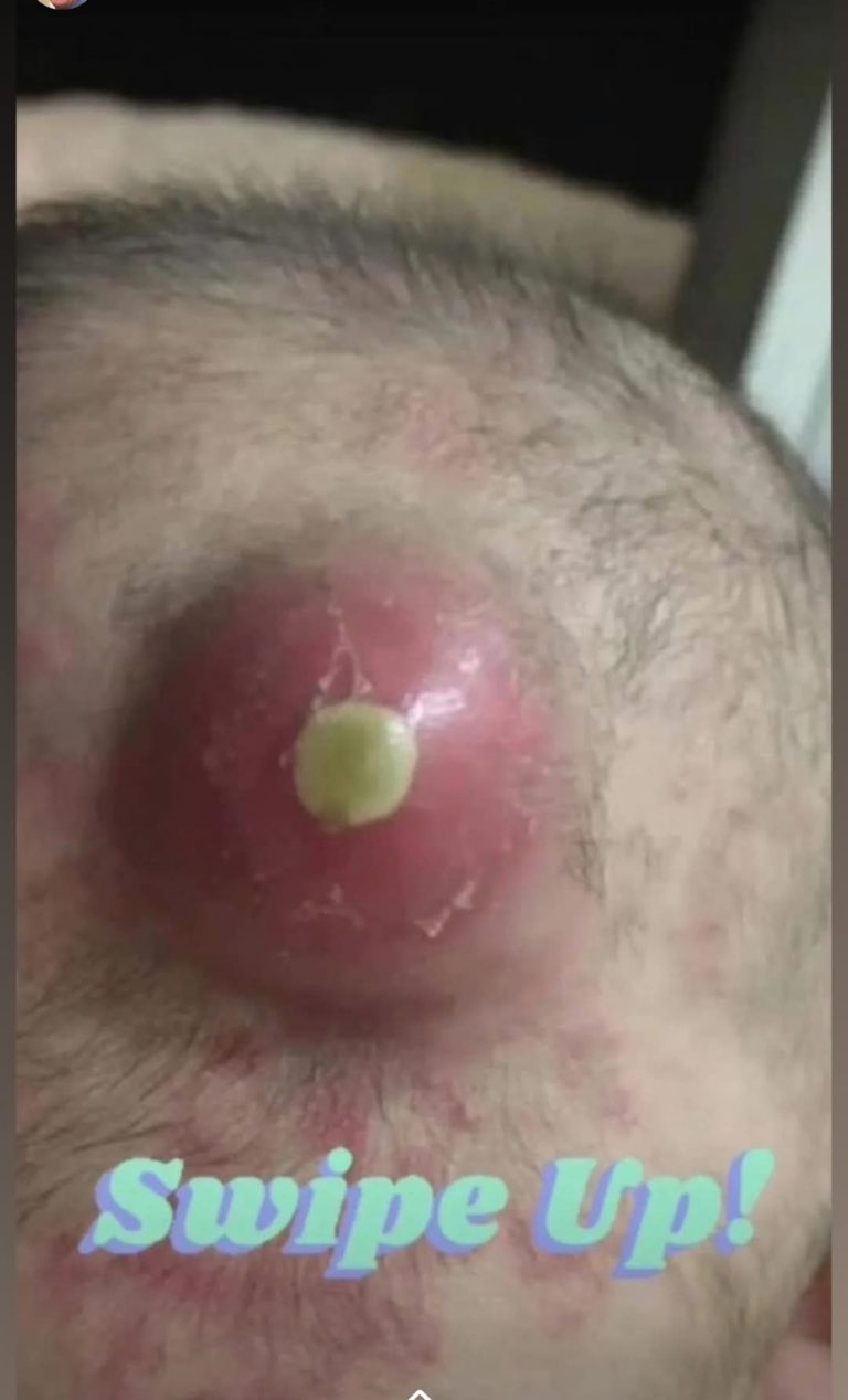 SUDDEN UNEXPLAINED SYMPTOMS!!!