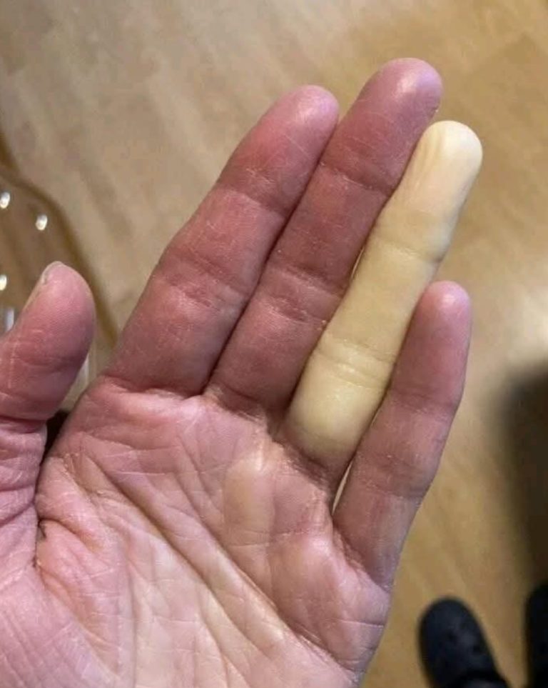 These are the consequences of sleeping co! See now!