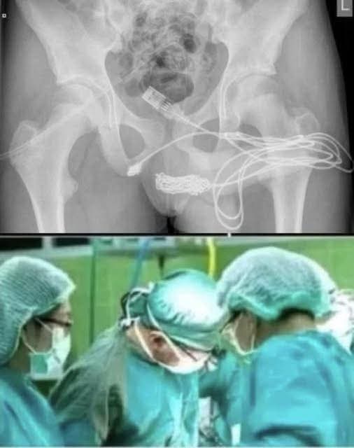 😱Girl was hospitalized for trying one more pen…See more