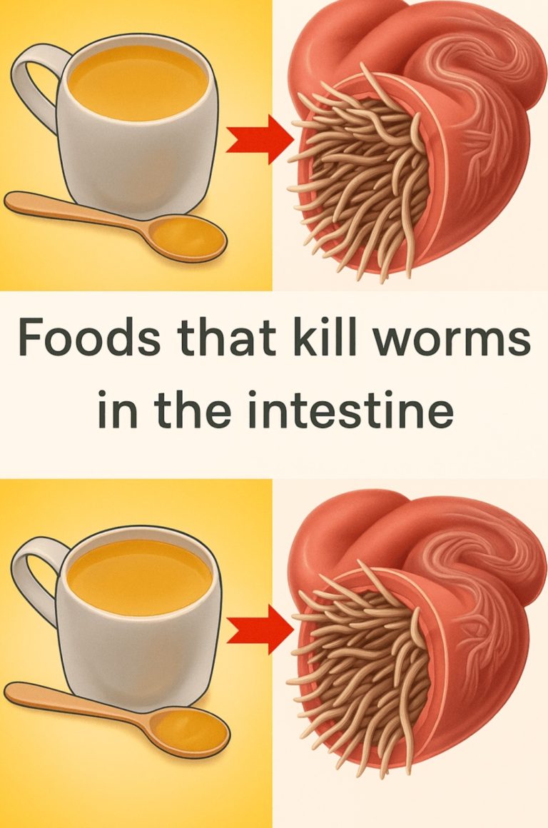 7 Foods That Kill Worms in the Intestine