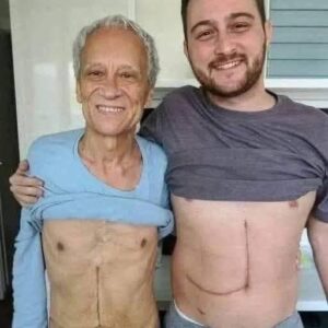Son who donated part of his liver to his father unfortunately ends up fa… See more
