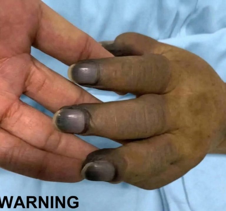 What Constant Nail Polish Use Can Do to Your Nails