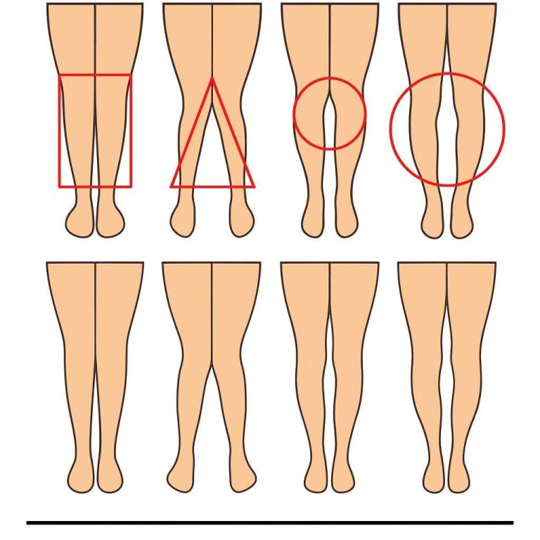 Silent Secrets of Women’s Legs