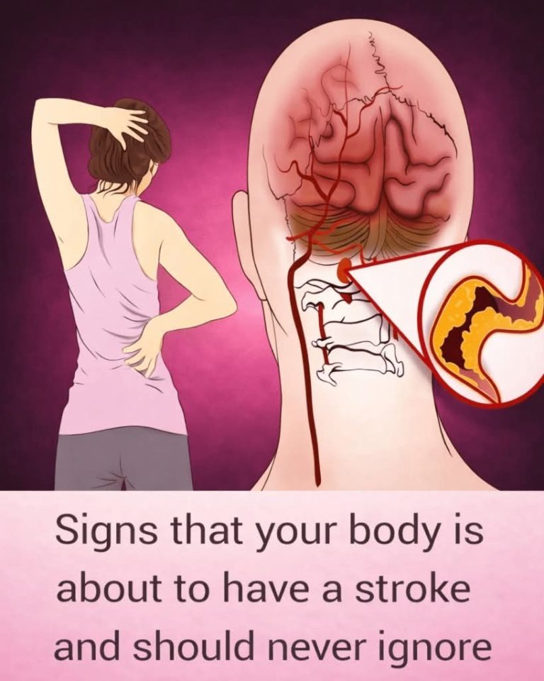 Doctors Warn: If You Feel These Symptoms, Act Immediately! 🚨​👇 Click the link below to read the full guide and know exactly what to look out for⬇️⬇️